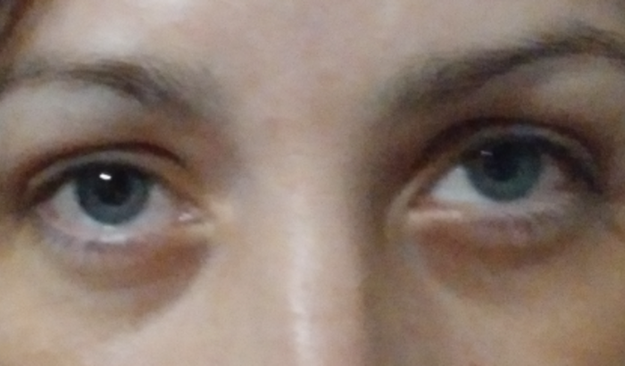 Ajuda-me a ir no oftalmologista estou com glaucoma sofro muito 