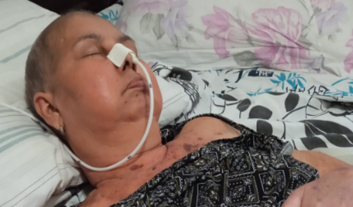 O CANCER NÃO ESPERA