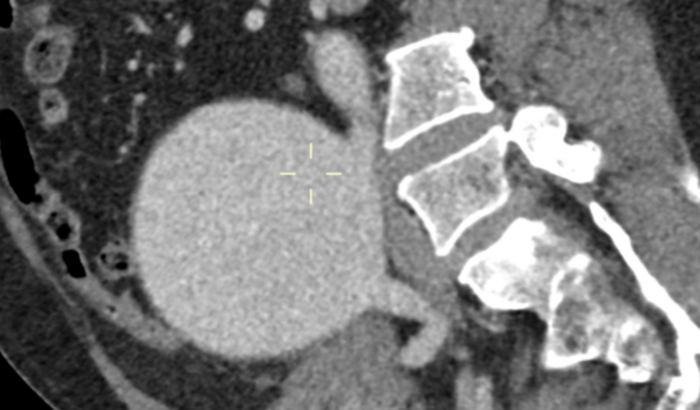 Cirurgia vascular - Albino Bastos