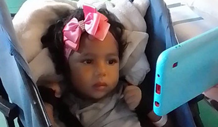 Tratamento da Lorena traumatismo craniano acidente de moto