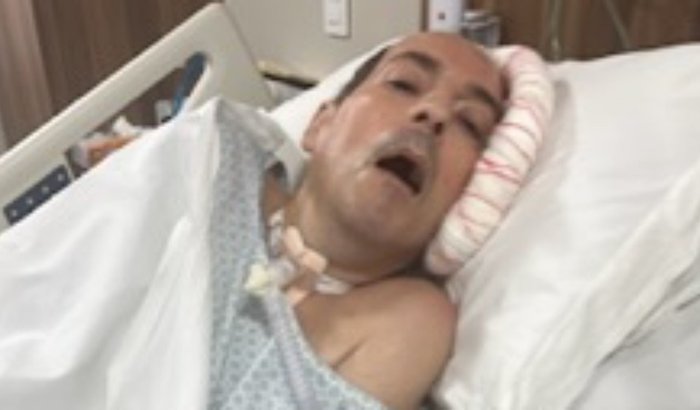 Hércules Beltramini