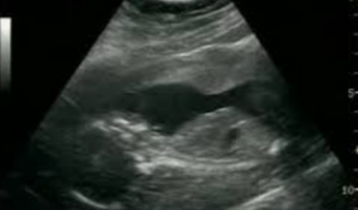 Cesária da Manuella 