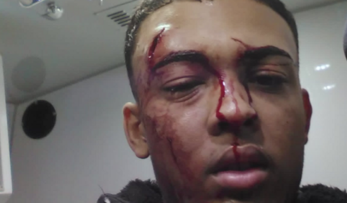 AJUDAR O NOSSO AMIGO DO ACIDENTE