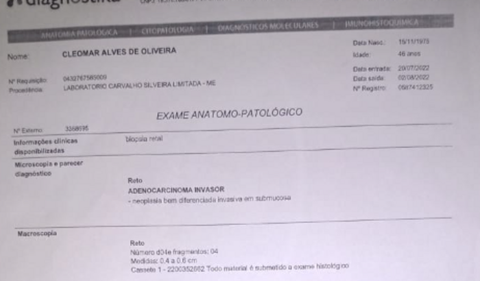 Cleomar Alves Tratamento de cancer no Intestino