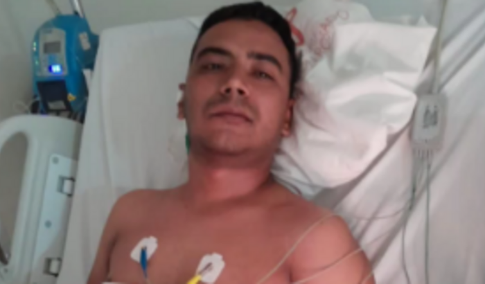 Tratamento radio terapia