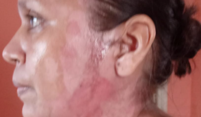 Ajude a Recuperação de Alexandra !!!