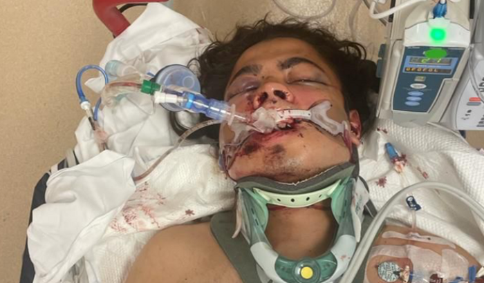 João recuperação médica