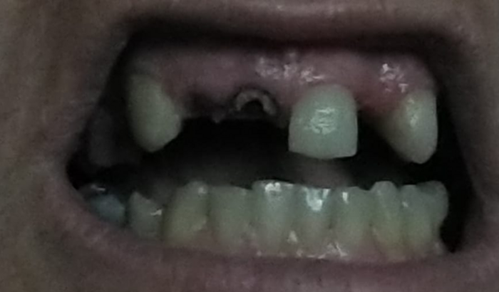 Ajuda para arrumar os dentes