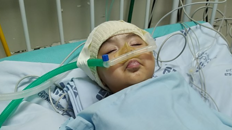 AME ATROFIA MUSCULAR ESPINHAL 