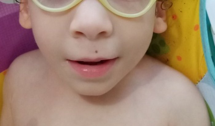 TRATAMENTO  REGENERATIVO MICRO DANILO