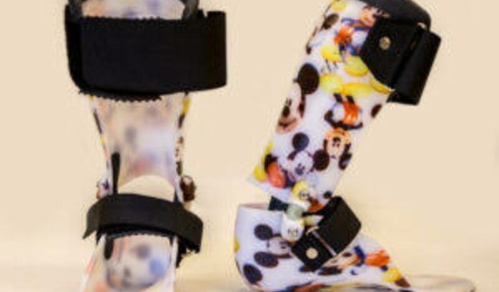 Ajuda de Orteses Pra Allana