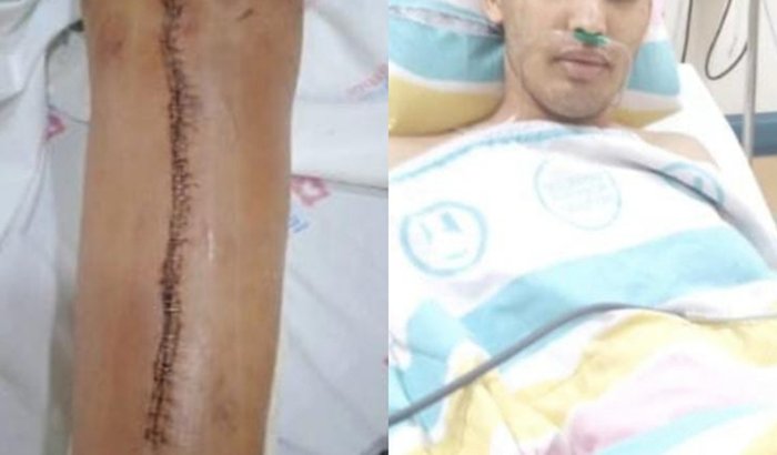 Ajuda para tratamento contra câncer maligno