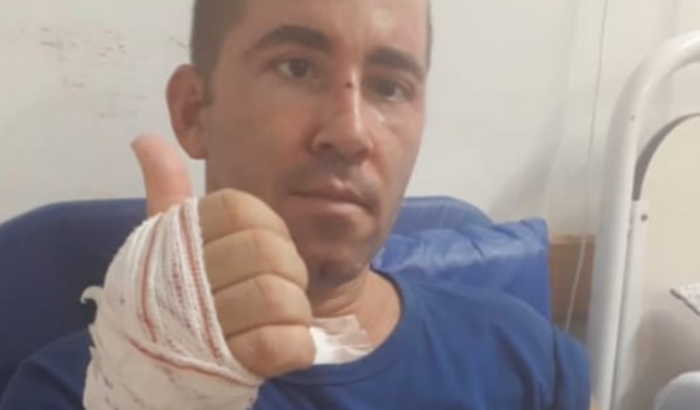 Em prol de Tetê para prótese de braço