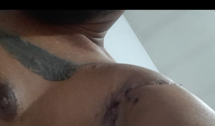 Ajuda na vida financeira do meu filho, devido ele ter se machucado no trabalho , foram acumulando tudo .