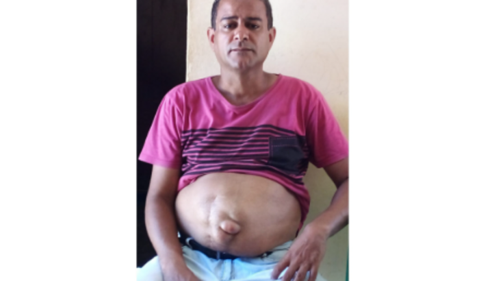 Ajude Hemerson Henrique a fazer sua Cirurgia de Hérnia