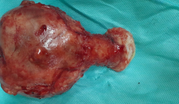 Ajuda para comprar remédio 