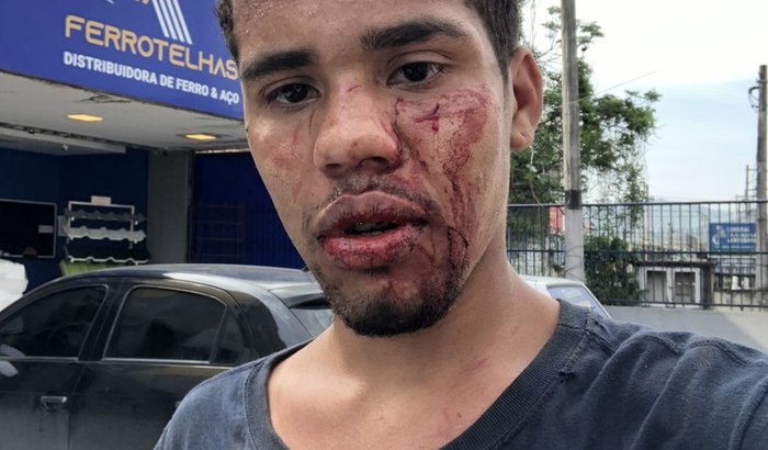 Ajuda para implante dentário 