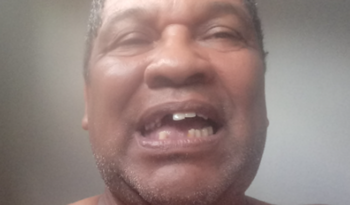 AJUDA PARA TRATAMENTO DENTÁRIO APÓS ACIDENTE 