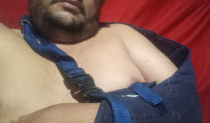 Recuperação de acidente