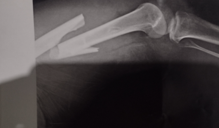 Solidariedade ao Henrique- A União Faz a Força