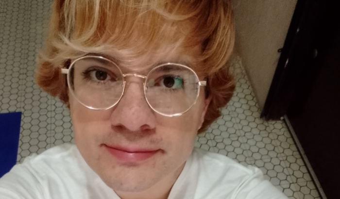 Sou trans e preciso retirar a barba a laser.
