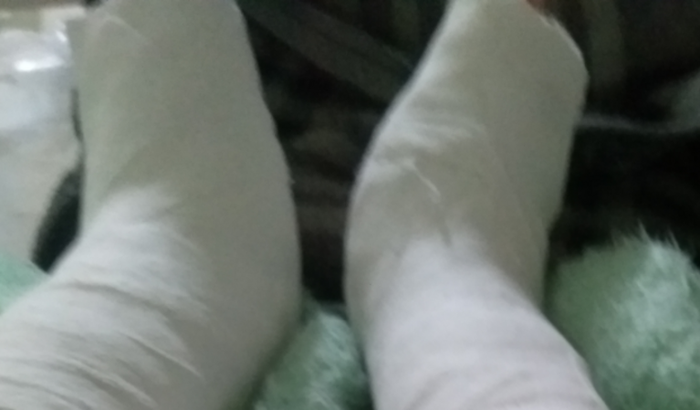 Tratamento pro meu filho especial