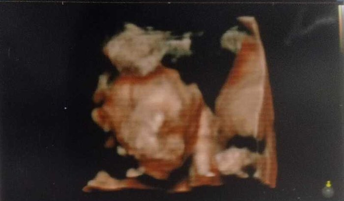 Ajuda para Ariane e sua filha ZOE