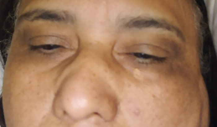 Professora fibromiálgica precisa de ajuda