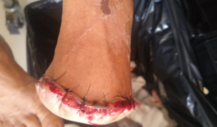 Colabore com a Vanei