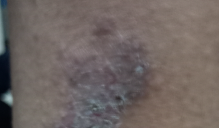 Ajudar a Emily com medicação