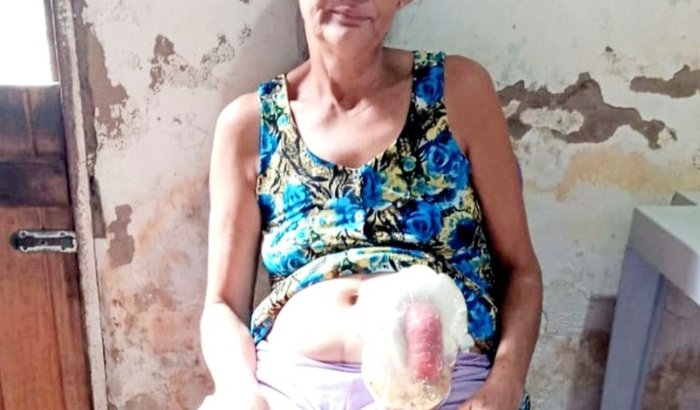 Câncer Ajudar a Luciene minha comadre