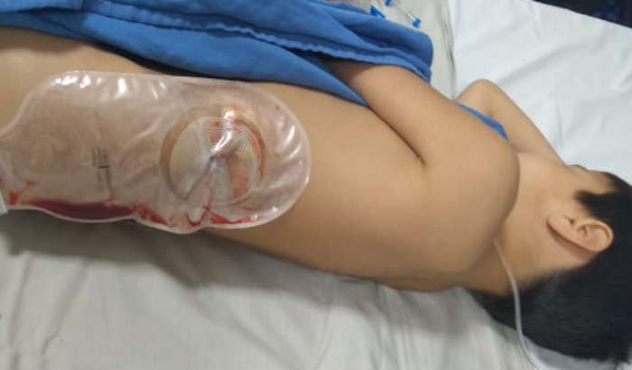 Ajude a salvar o rim do menino Pedro 