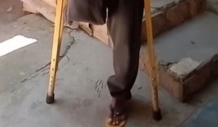 Perna mecânica para o Zezinho!