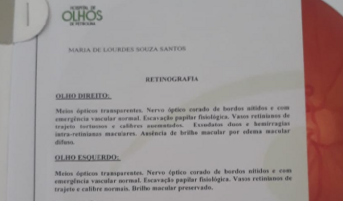 Perdi a visão de um olho, me ajude a não perder do outro,por favor