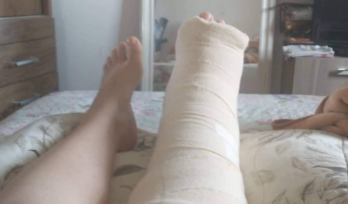 Ajuda com custos pós cirurgia e fisioterapia