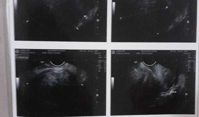 Salve a vida Deurinete