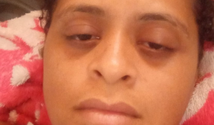 Ajude - me: Cirurgia para retirada do Útero.