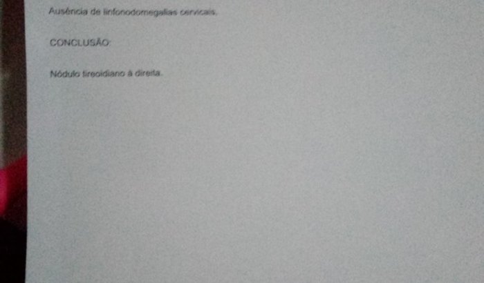 Infelizmente não estou conseguindo apoio para fazer minha cirurgia, quem puder ajudar fico agradecida 🙌