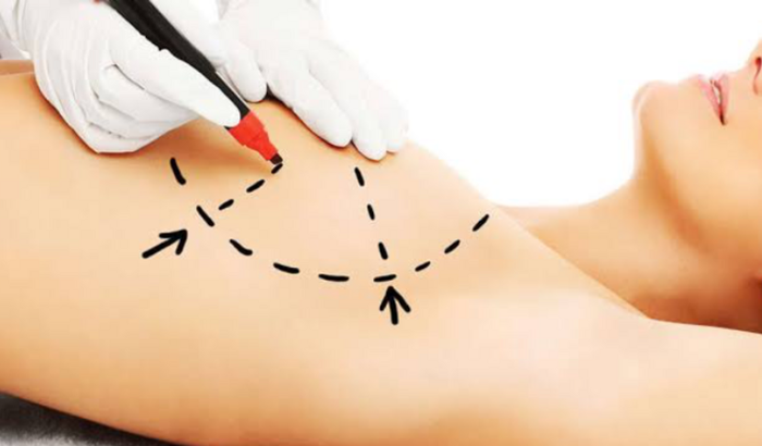 Contribuição cirurgia Kelly