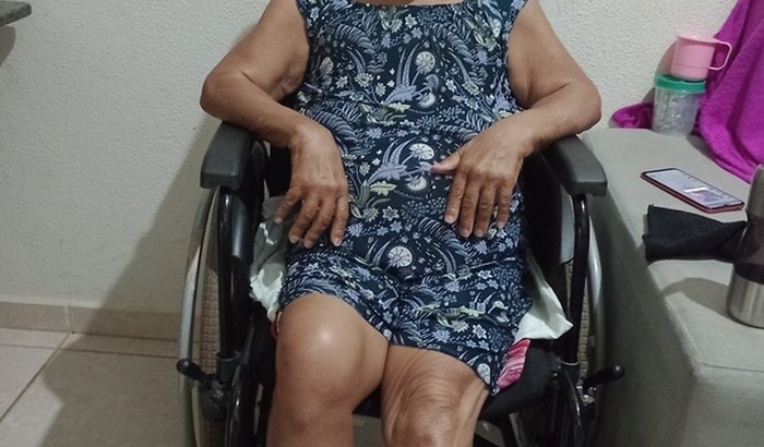 Ola pessoal mim chamo Alessonia essa e minha mãe ela passou por uma cirurgia da perna esquerda há 5 meses. 