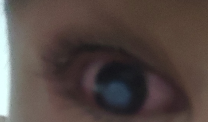 Ajuda no Oftomologista do Matheus 