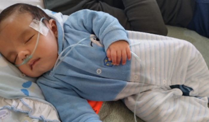 Cirurgia do Pyetro em retirada de cisto na cabeça