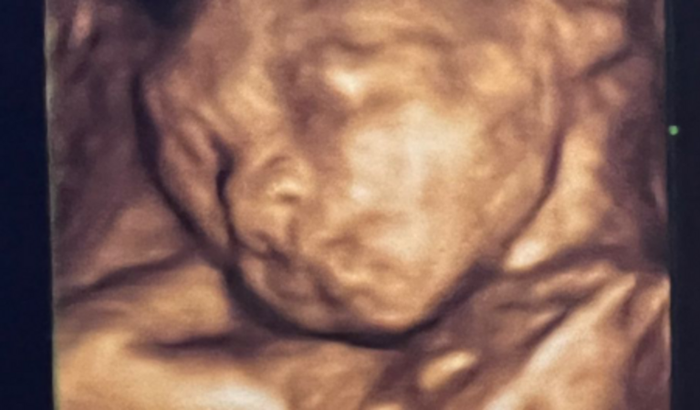 Chá de Bebe do Dom