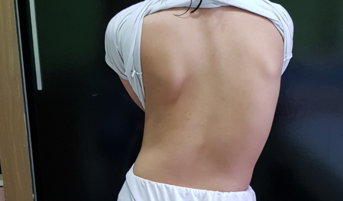 Colete para Vitória