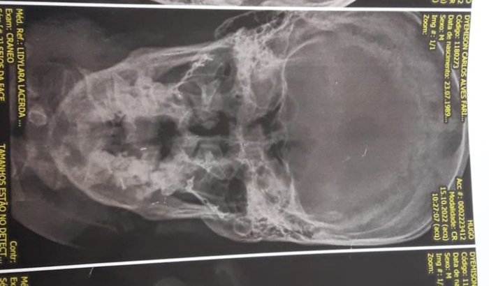 Remédio e Tratamento - Dyemison SAD MOTOS