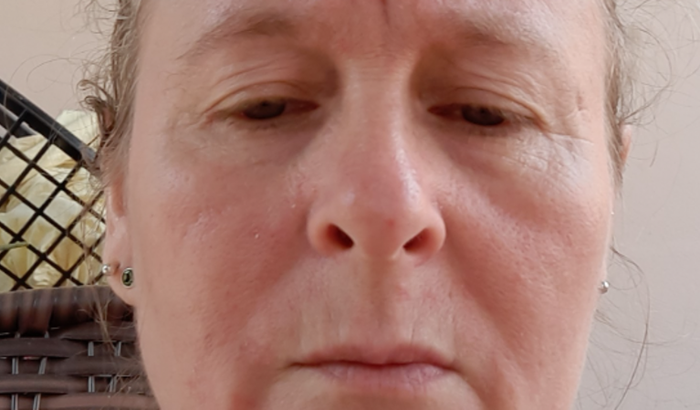 Ajuda pra fazer uma colonoscopia com biopsia preciso urgente 