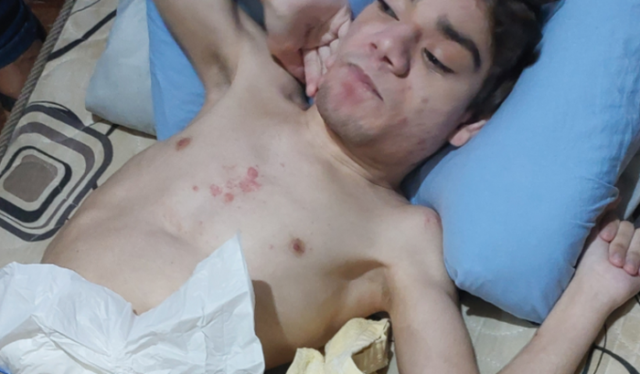 Patrick precisa de sua ajuda