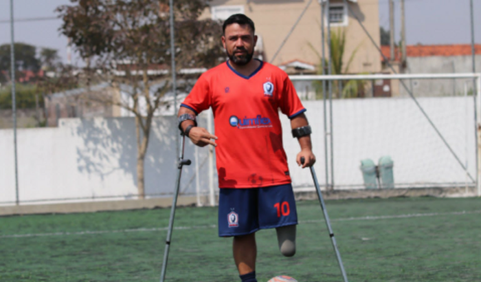 Uma prótese para o Ricardo