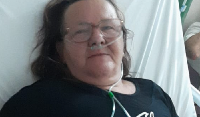 Oxigênio- Efisema Pulmonar 