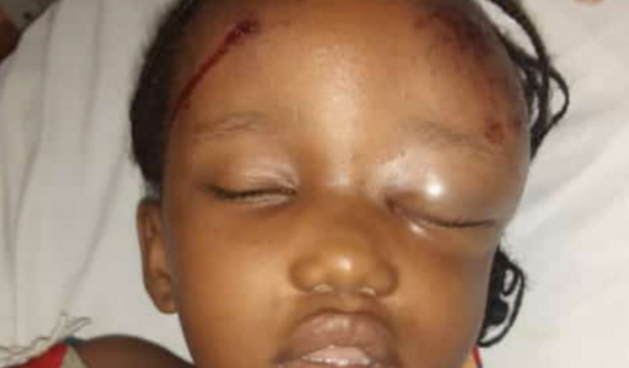 Vamos ajudar a Coralie ela precisa de tratamento, pois sofreu um acidente, pfvor preciso de ajuda de todos nessa causa